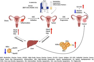 Stratification of ovarian cancer borderline from high-grade serous carcinoma patients by quantitative serum NMR spectroscopy of metabolites, lipoproteins, and inflammatory markers
